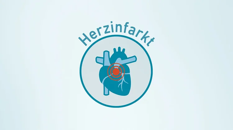 Grafik zeigt Herz mit Markierung als Symbol für Herzinfarkt.