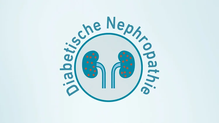 Grafik zeigt Nieren mit roten Punkten als Zeichen diabetischer Nephropathie.