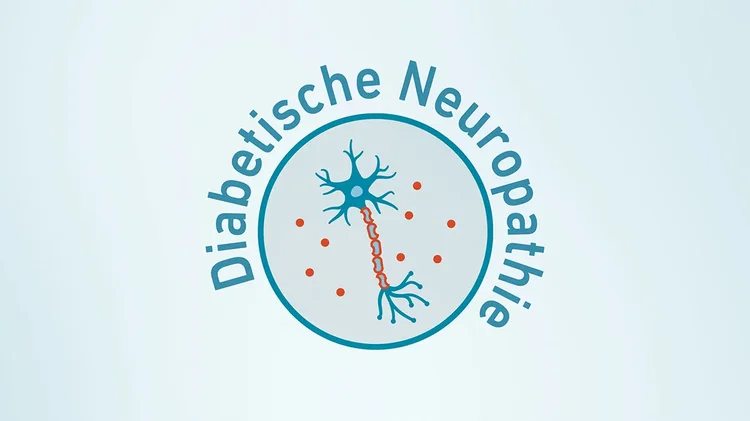 Grafik einer Nervenzelle mit Schäden durch diabetische Neuropathie.