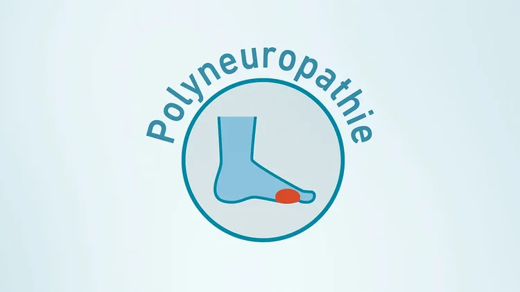 Grafik zeigt Fuß mit rotem Bereich als Zeichen für Polyneuropathie.