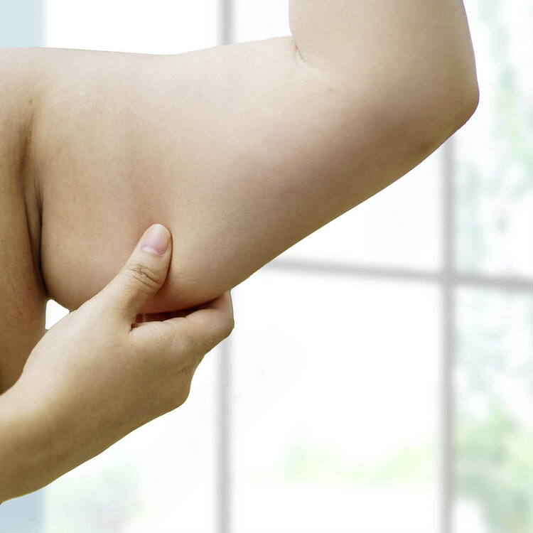 Frauenarm mit Muskelverlust