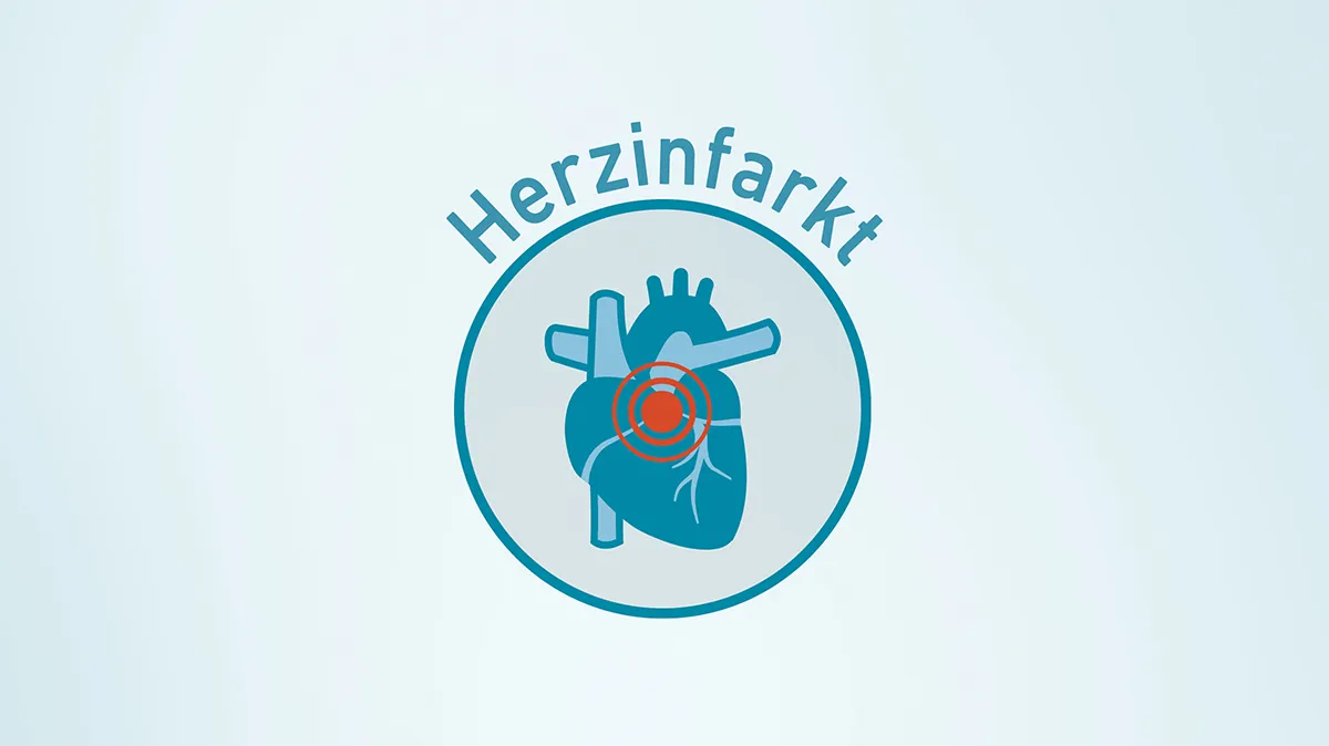Grafik zeigt Herz mit Markierung als Symbol für Herzinfarkt.
