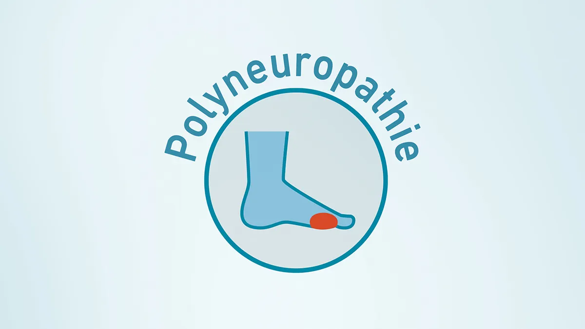 Grafik zeigt Fuß mit rotem Bereich als Zeichen für Polyneuropathie.