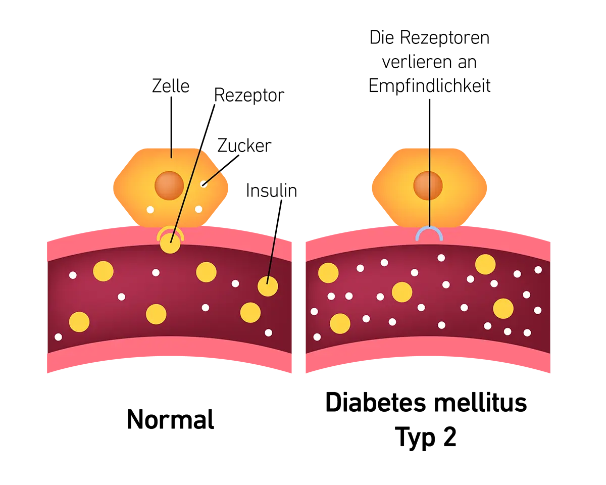 Grafik zeigt, wie Insulin Glukose in Körperzellen transportiert.