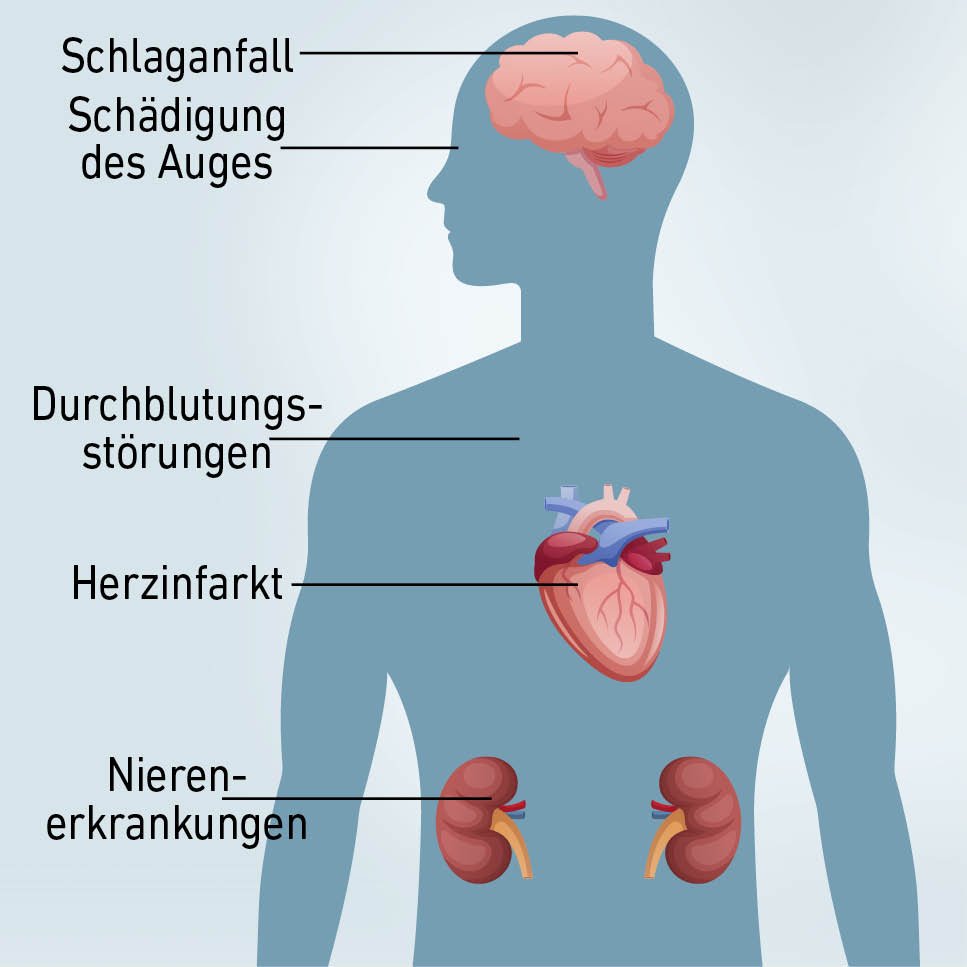 Adipositas und Kinderwunsch - Positive Effekte von Gewuchtsreduktion im Kinderwunsch bei Frau und Mann